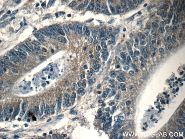 PAFAH Antibody in Immunohistochemistry (Paraffin) (IHC (P))