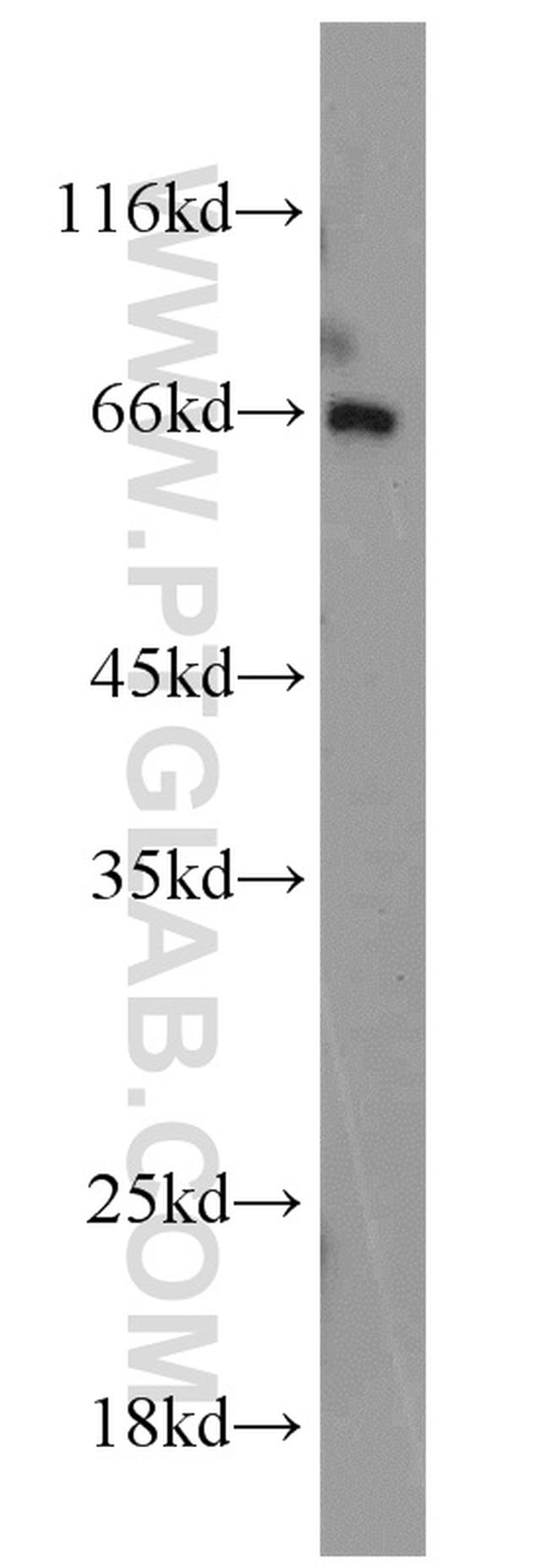 PAFAH Antibody in Western Blot (WB)