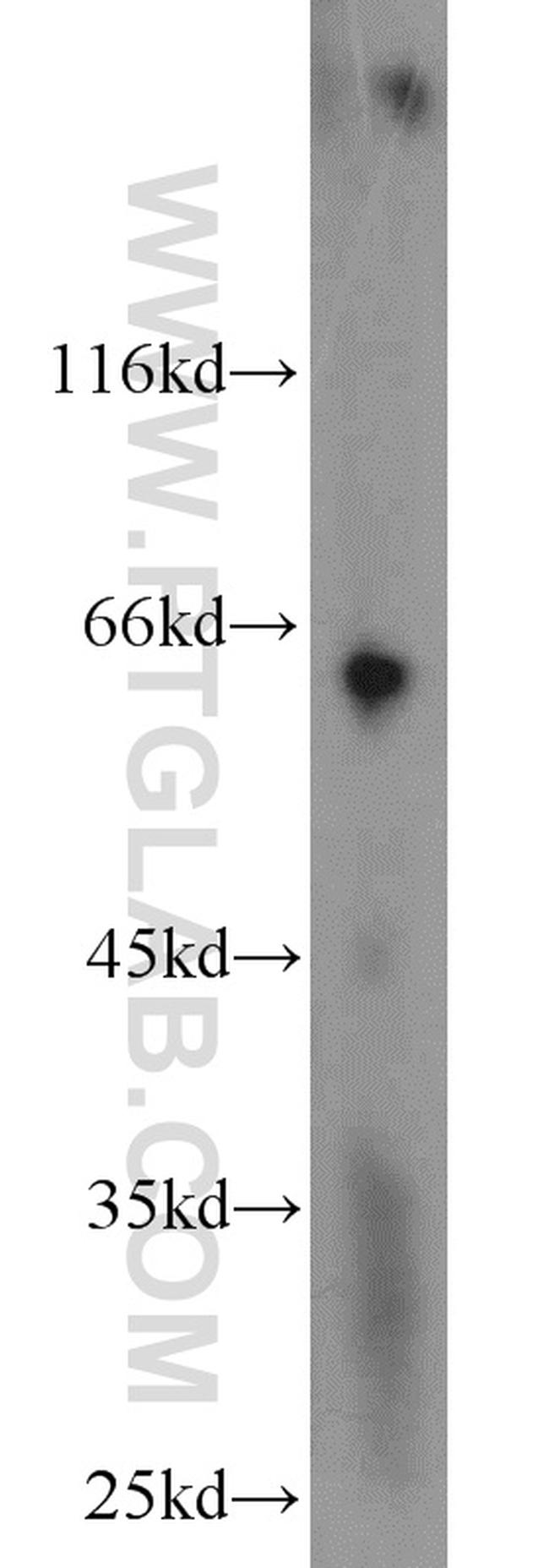 PAFAH Antibody in Western Blot (WB)