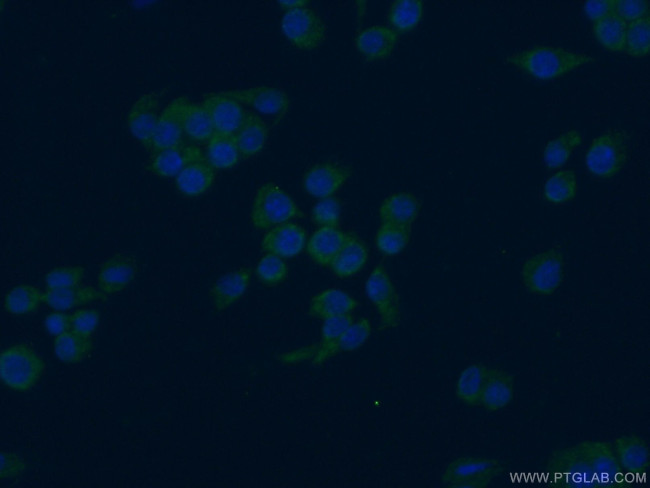 PAFAH Antibody in Immunocytochemistry (ICC/IF)