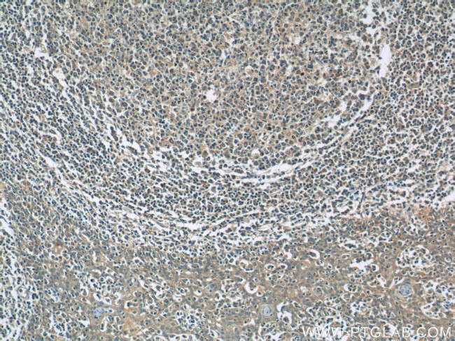 PAFAH Antibody in Immunohistochemistry (Paraffin) (IHC (P))