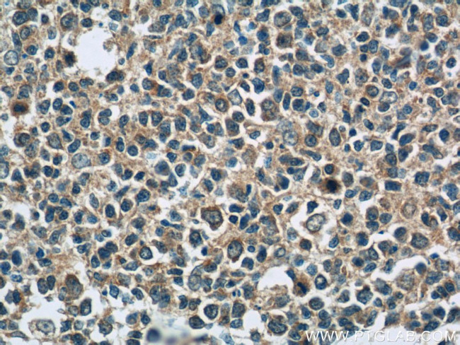 PAFAH Antibody in Immunohistochemistry (Paraffin) (IHC (P))