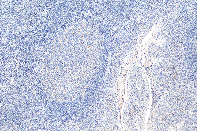 PAFAH Antibody in Immunohistochemistry (Paraffin) (IHC (P))