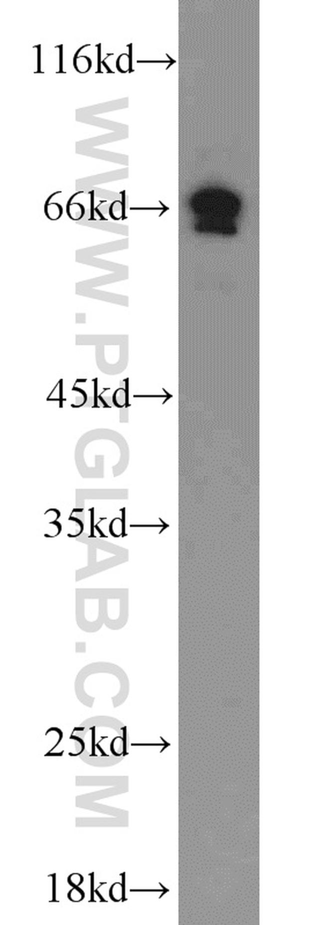 PAFAH Antibody in Western Blot (WB)