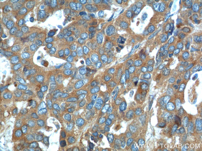 PRSS8 Antibody in Immunohistochemistry (Paraffin) (IHC (P))