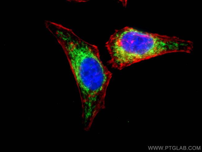 CABC1 Antibody in Immunocytochemistry (ICC/IF)