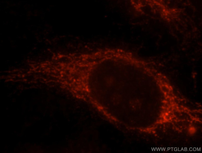 CABC1 Antibody in Immunocytochemistry (ICC/IF)