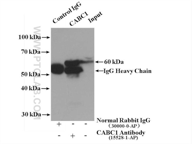 CABC1 Antibody in Immunoprecipitation (IP)