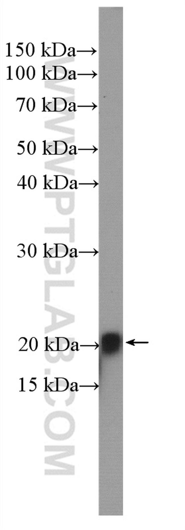 HRAS Antibody in Western Blot (WB)