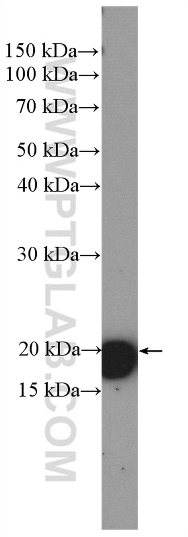 HRAS Antibody in Western Blot (WB)