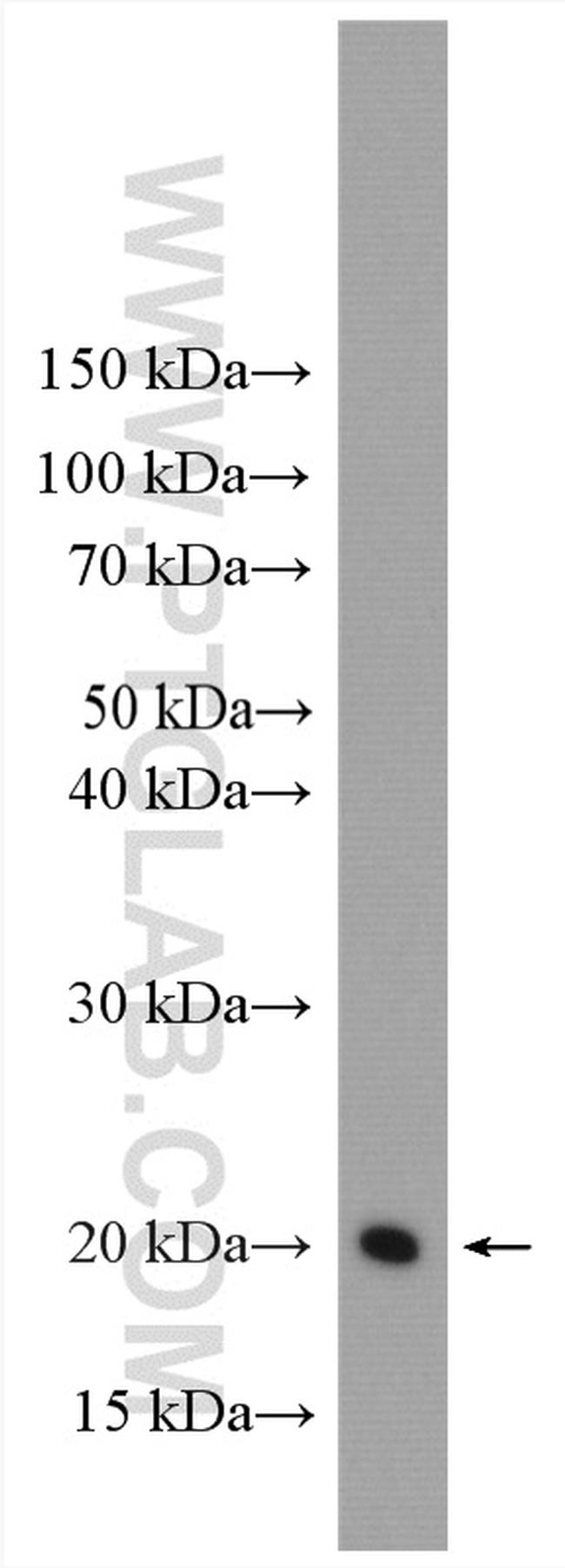 HRAS Antibody in Western Blot (WB)