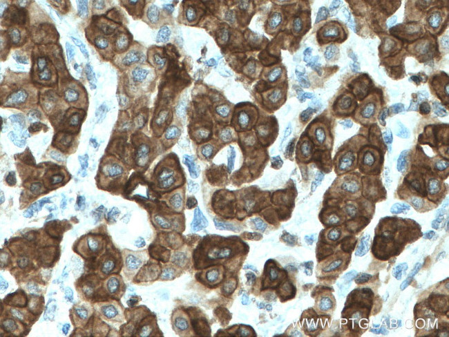 Cytokeratin 7 Antibody in Immunohistochemistry (Paraffin) (IHC (P))