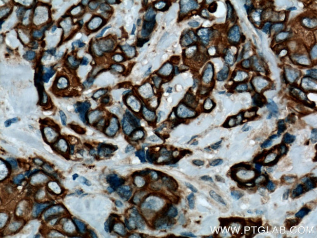 Cytokeratin 7 Antibody in Immunohistochemistry (Paraffin) (IHC (P))