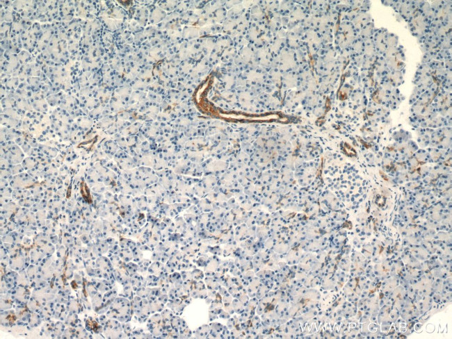 Cytokeratin 7 Antibody in Immunohistochemistry (Paraffin) (IHC (P))