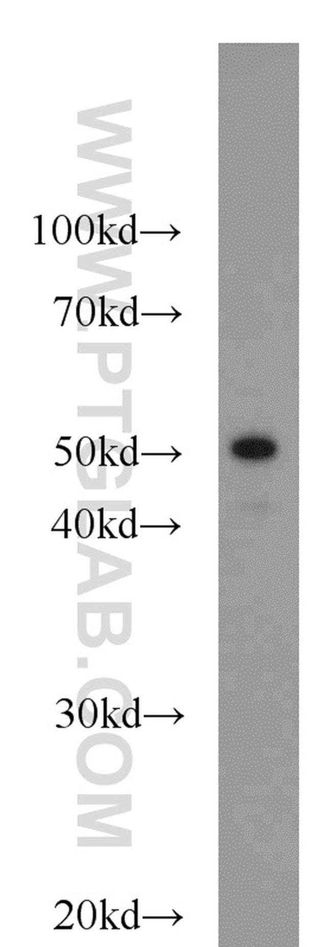 Cytokeratin 7 Antibody in Western Blot (WB)