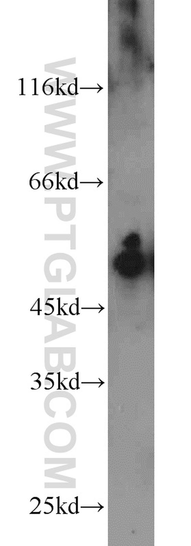 Cytokeratin 7 Antibody in Western Blot (WB)