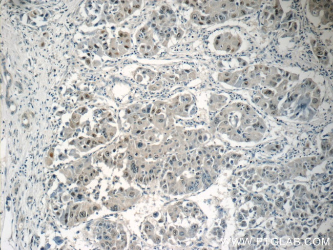 TRPT1 Antibody in Immunohistochemistry (Paraffin) (IHC (P))