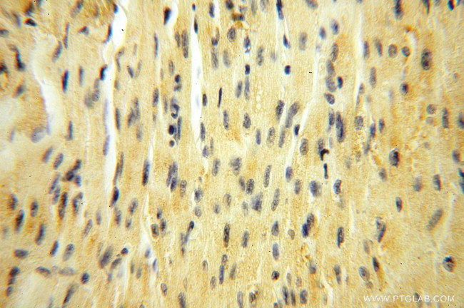 MRPL11 Antibody in Immunohistochemistry (Paraffin) (IHC (P))