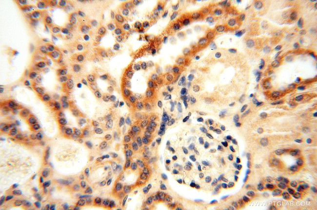 MRPL11 Antibody in Immunohistochemistry (Paraffin) (IHC (P))