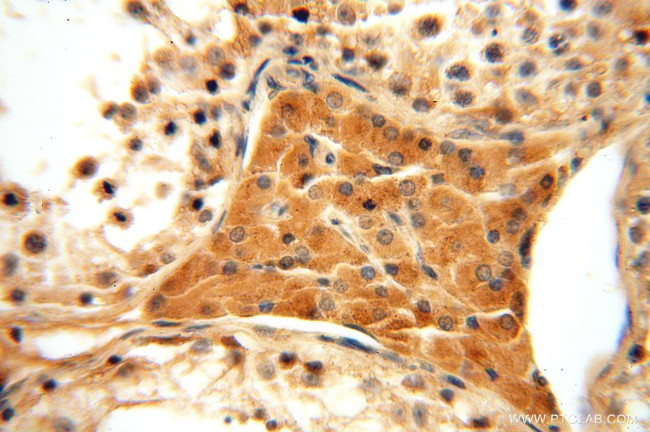 MRPL11 Antibody in Immunohistochemistry (Paraffin) (IHC (P))