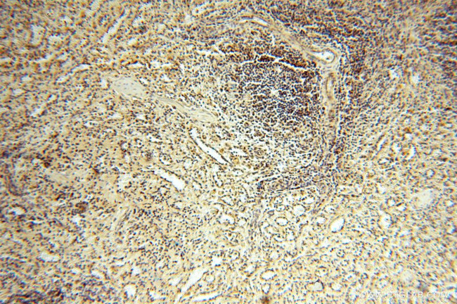 MRPL11 Antibody in Immunohistochemistry (Paraffin) (IHC (P))