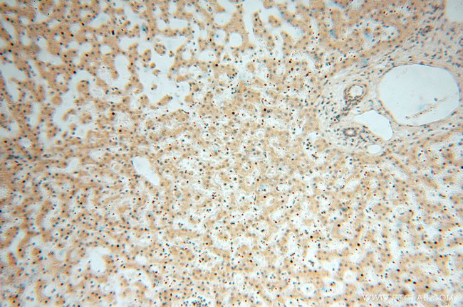 MRPL11 Antibody in Immunohistochemistry (Paraffin) (IHC (P))