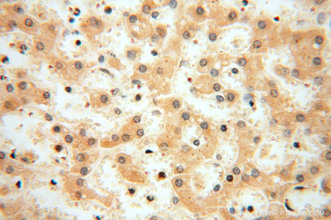 MRPL11 Antibody in Immunohistochemistry (Paraffin) (IHC (P))