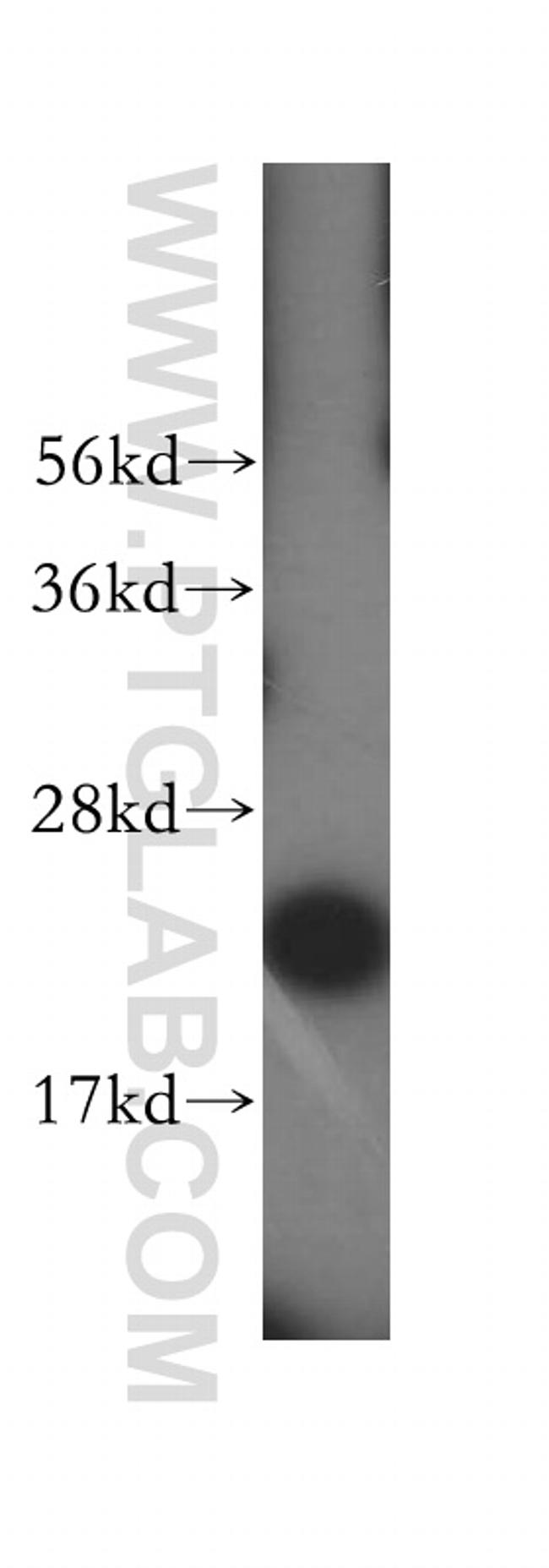 MRPL11 Antibody in Western Blot (WB)