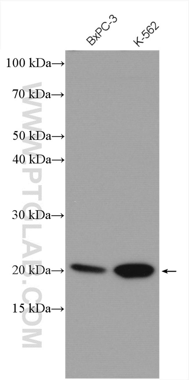 MRPL11 Antibody in Western Blot (WB)