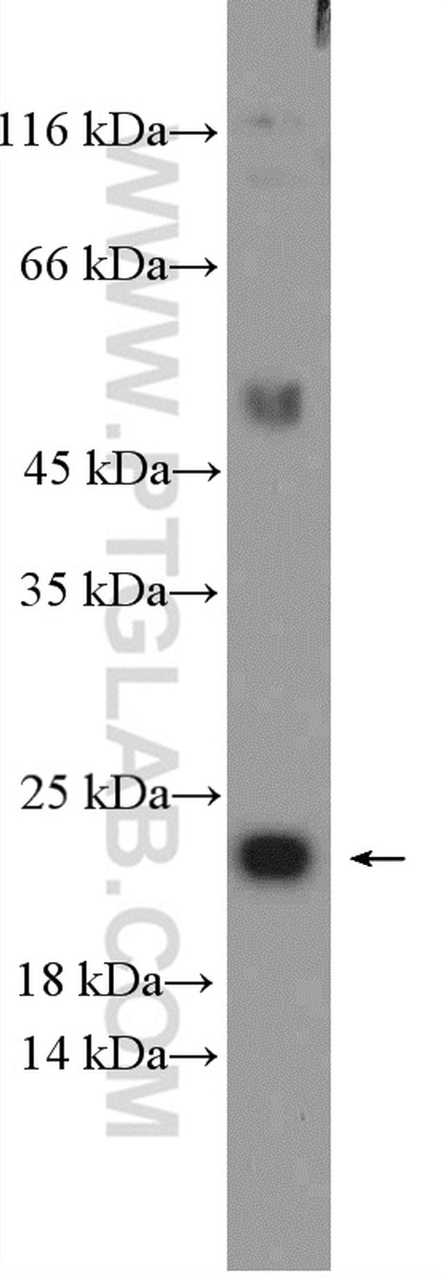 MRPL11 Antibody in Western Blot (WB)