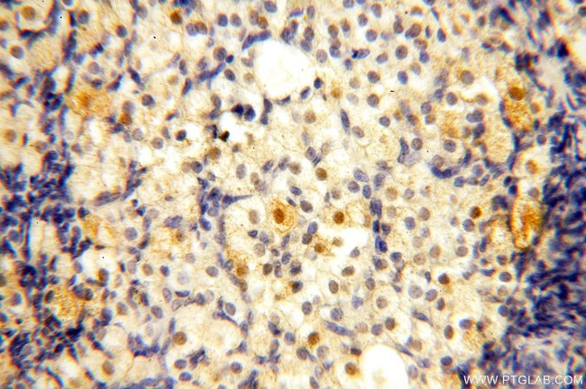 WDR5 Antibody in Immunohistochemistry (Paraffin) (IHC (P))