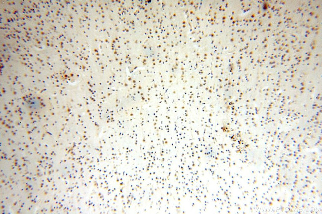 WDR5 Antibody in Immunohistochemistry (Paraffin) (IHC (P))