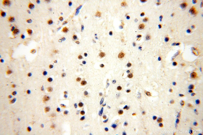 WDR5 Antibody in Immunohistochemistry (Paraffin) (IHC (P))