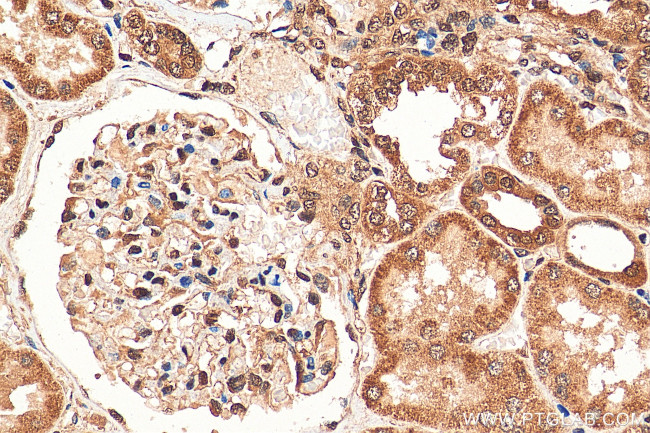 WDR5 Antibody in Immunohistochemistry (Paraffin) (IHC (P))