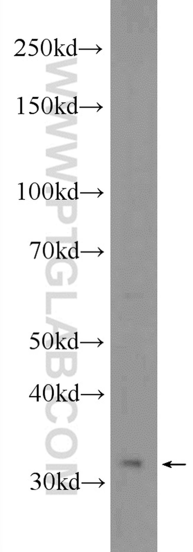 WDR5 Antibody in Western Blot (WB)