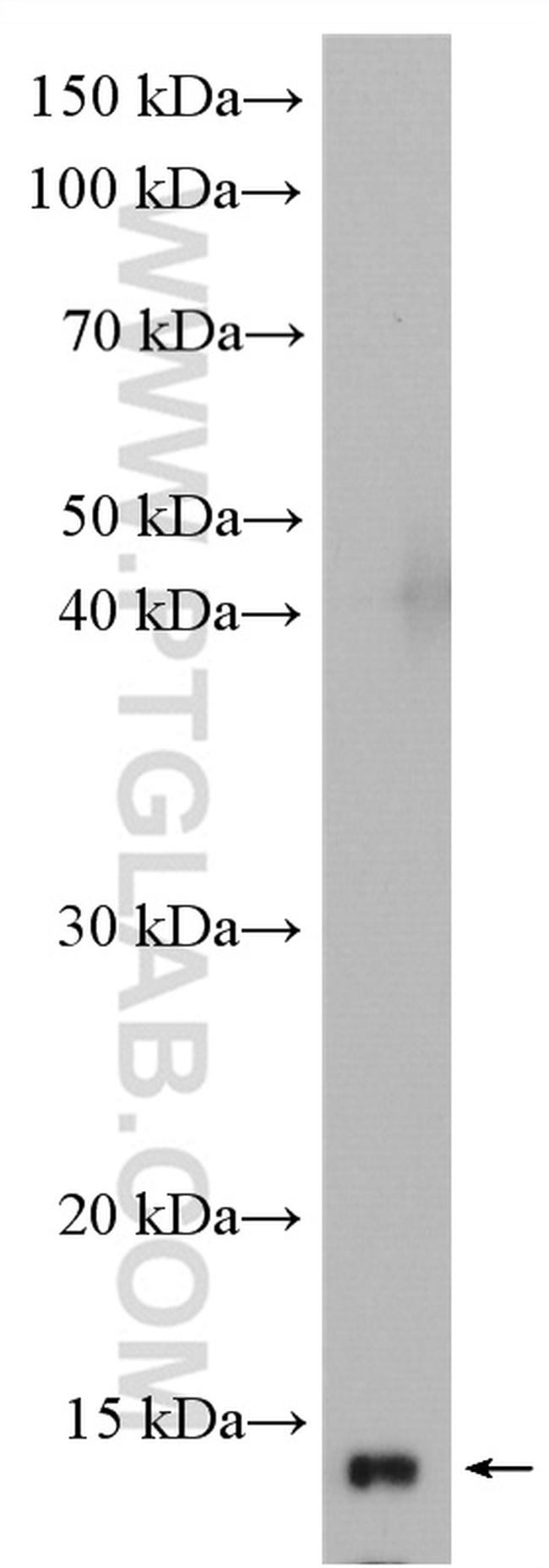 VAMP8 Antibody in Western Blot (WB)