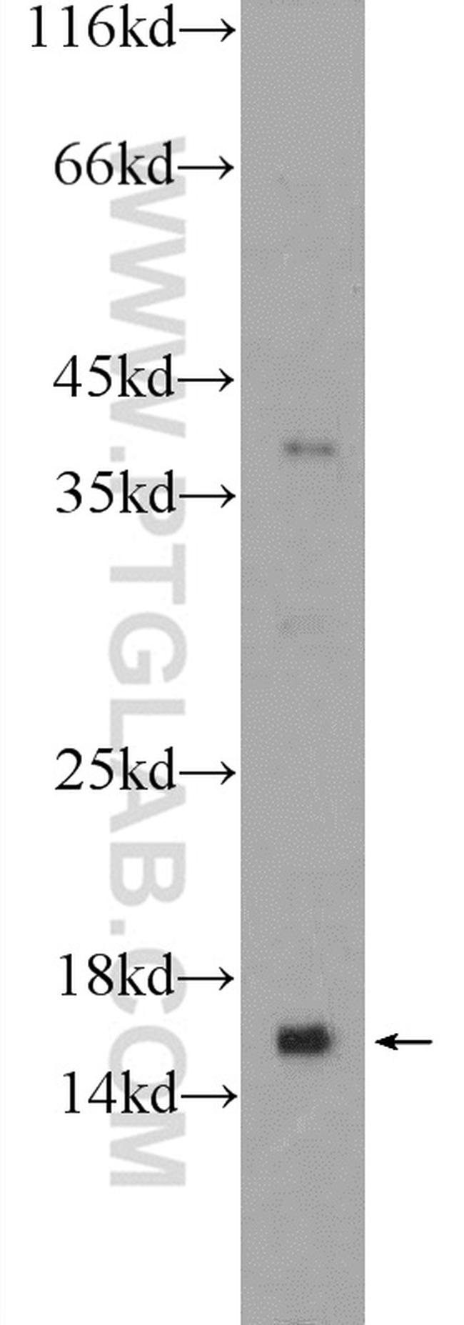 VAMP8 Antibody in Western Blot (WB)