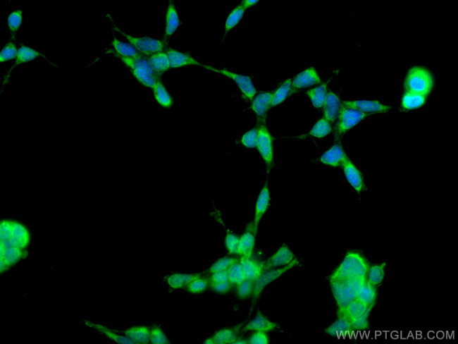 UROD Antibody in Immunocytochemistry (ICC/IF)