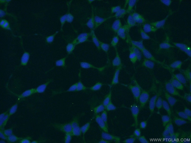 UROD Antibody in Immunocytochemistry (ICC/IF)