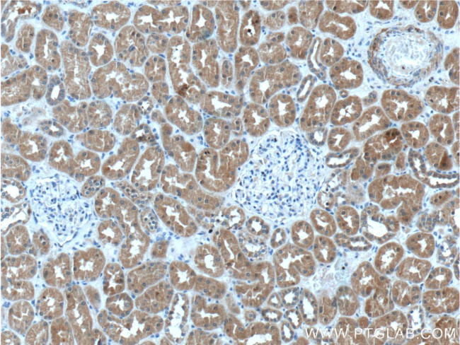 UROD Antibody in Immunohistochemistry (Paraffin) (IHC (P))