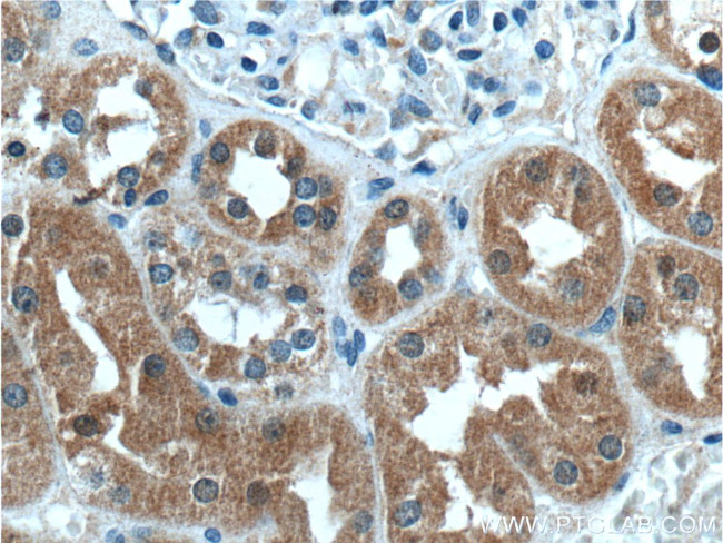 UROD Antibody in Immunohistochemistry (Paraffin) (IHC (P))