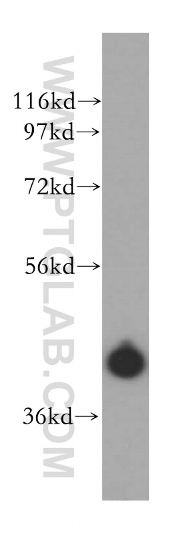 UROD Antibody in Western Blot (WB)