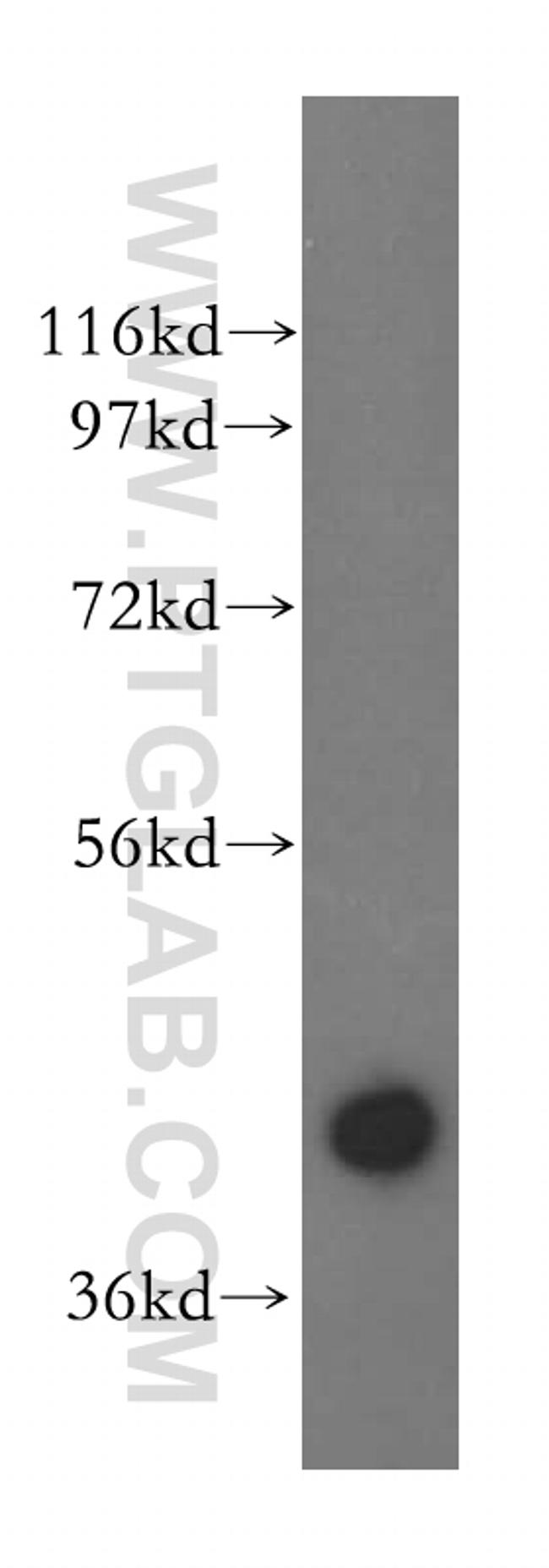 UROD Antibody in Western Blot (WB)