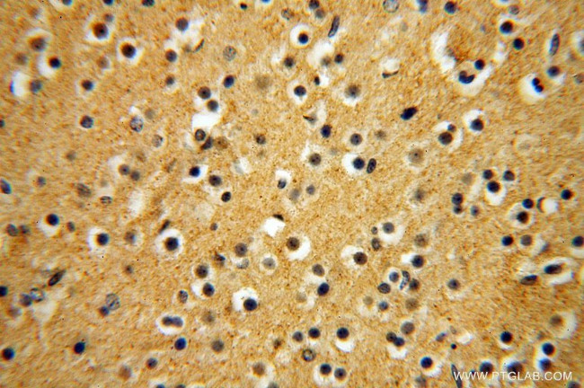 NADK Antibody in Immunohistochemistry (Paraffin) (IHC (P))