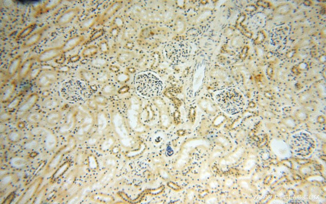 NADK Antibody in Immunohistochemistry (Paraffin) (IHC (P))