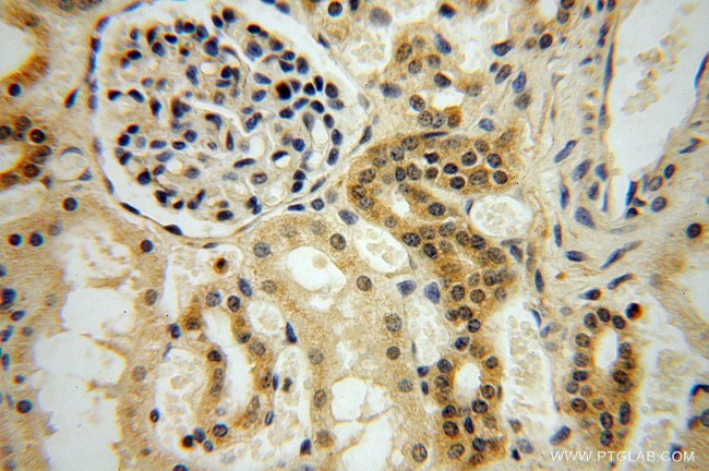 NADK Antibody in Immunohistochemistry (Paraffin) (IHC (P))