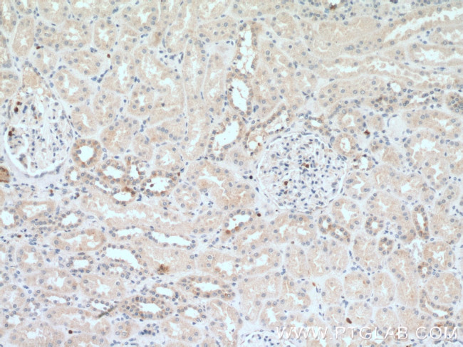 NADK Antibody in Immunohistochemistry (Paraffin) (IHC (P))