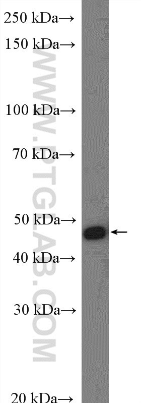 NADK Antibody in Western Blot (WB)