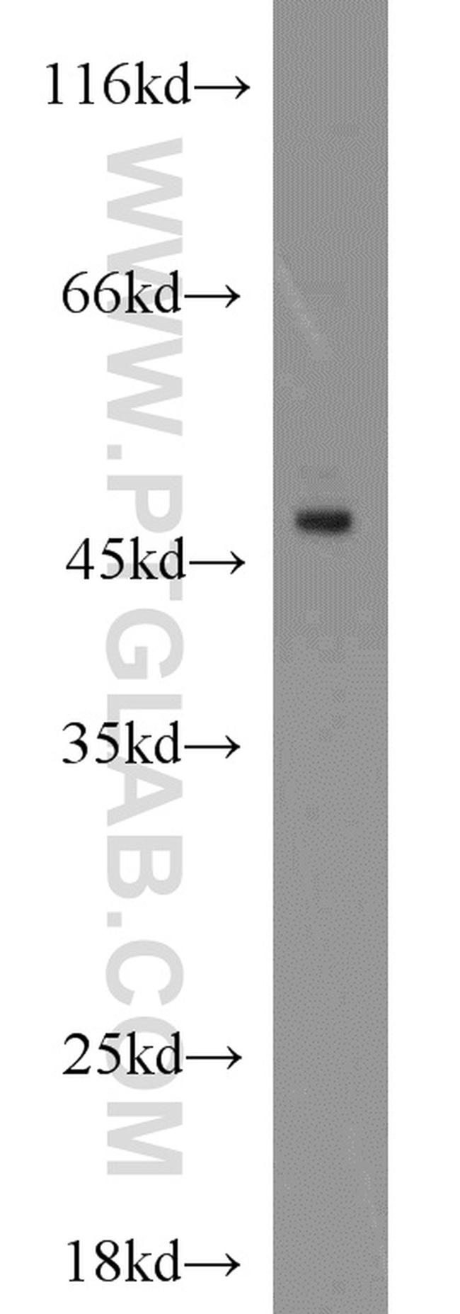 NADK Antibody in Western Blot (WB)