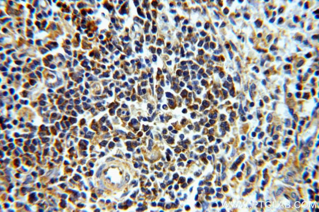 PRPS1 Antibody in Immunohistochemistry (Paraffin) (IHC (P))